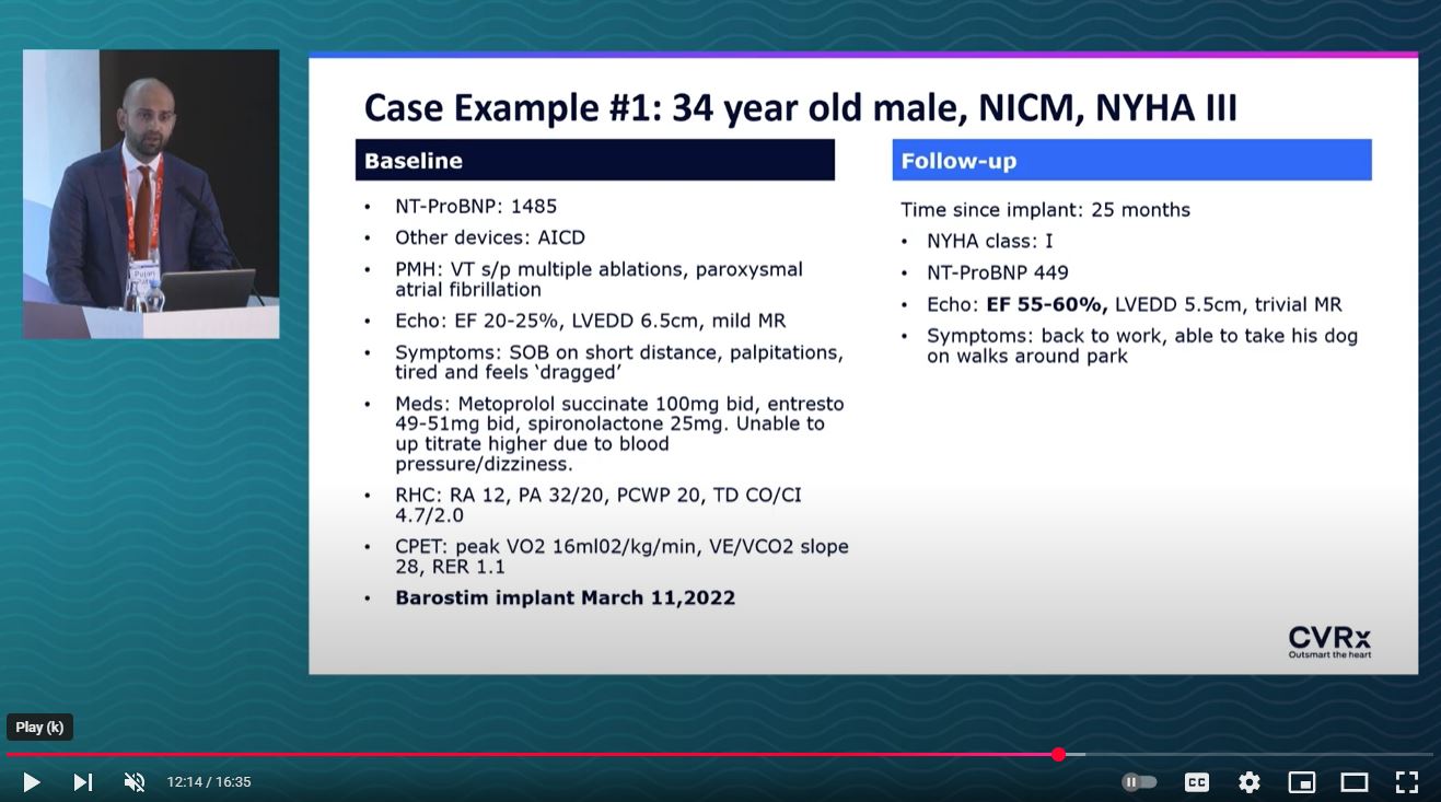Beyond BeAT-HF: Real World Experience with Barostim by Dr. Pujan Patel (ISHLT 2024)