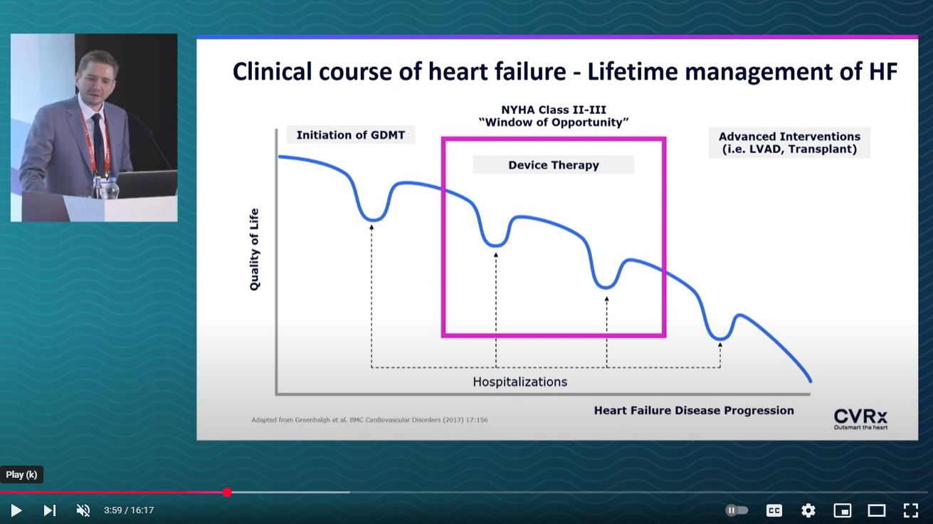 Integrating Barostim into a Comprehensive Heart Failure Program by Dr. Dmitry Yaranov (ISHLT 2024)