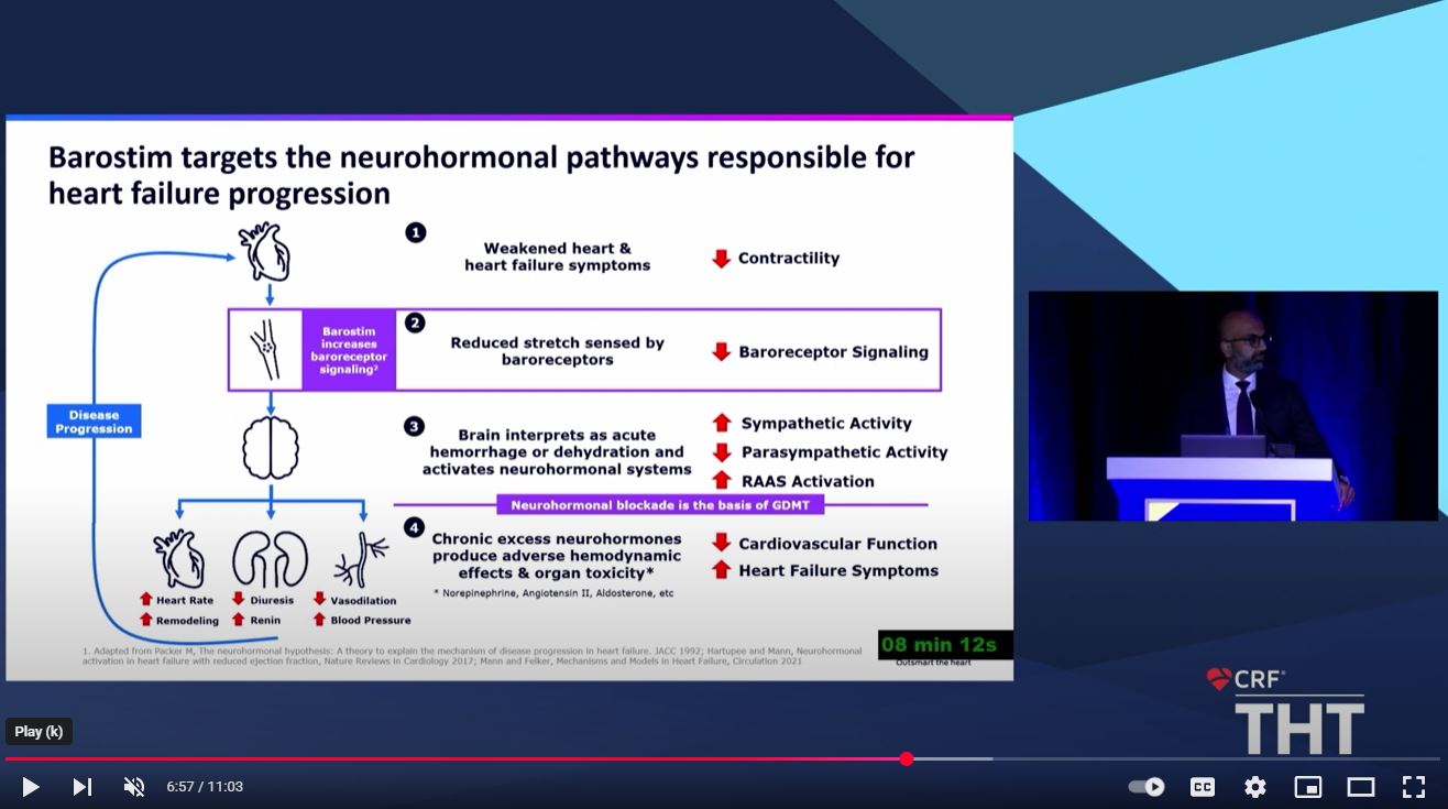 Drug and Device Therapies to Target the Neurohormonal Cascade by Dr. Rajeev Mohan (THT 2025)